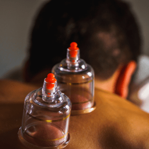 Homepage Cupping